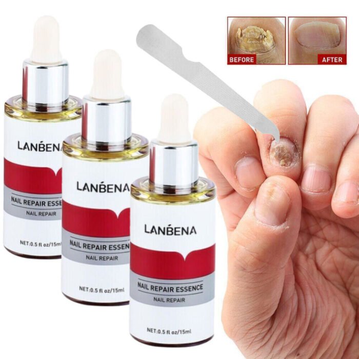 Lanbena Nail Repair Essence