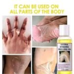 Aichun Beauty Extra Strong Peeling Oil