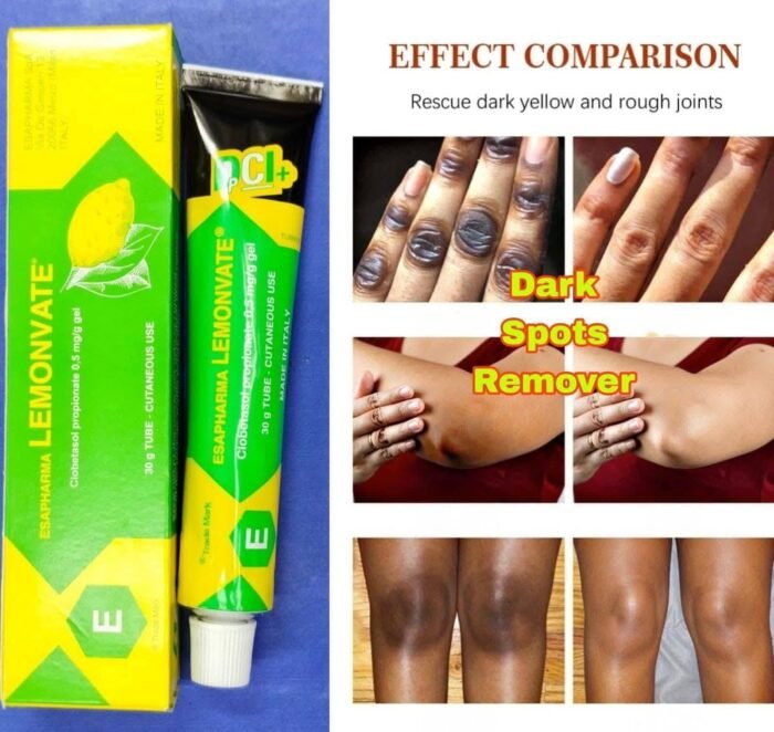 Lemonvate Cream