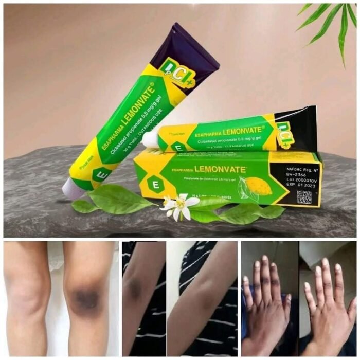 Lemonvate Cream